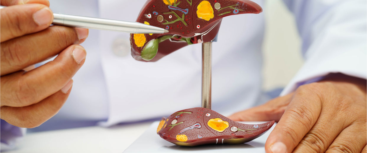 Cálculos biliares: as pedras na vesícula que você precisa conhecer