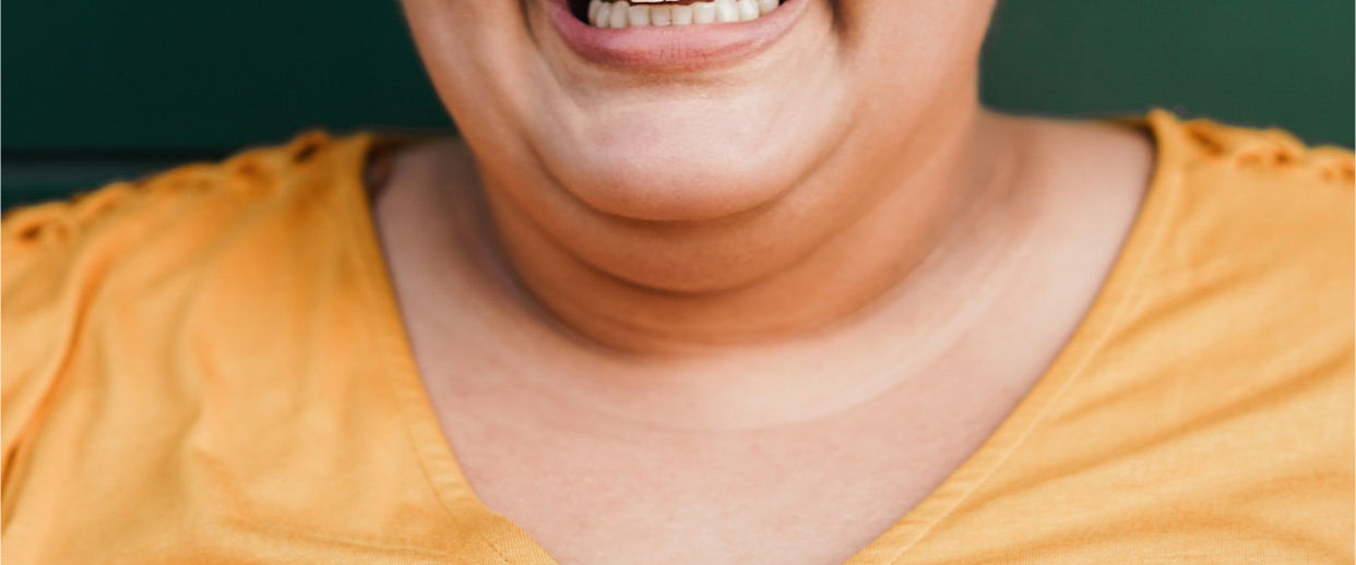 Gordura no pescoço: o que toda mulher precisa saber sobre papada e queixo duplo