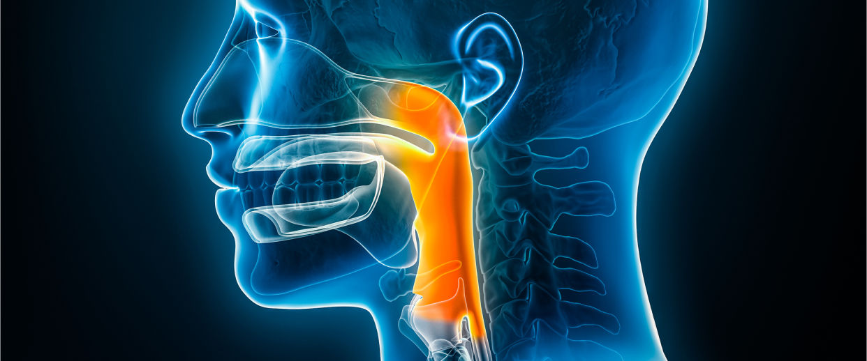 Refluxo gastroesofágico: quando o estômago decide fazer o caminho de volta